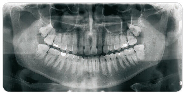 Advanced digital dental radiology equipment at Denticare India