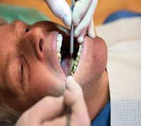In-office professional teeth whitening procedure