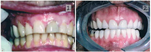 Advanced digital smile design consultation and planning