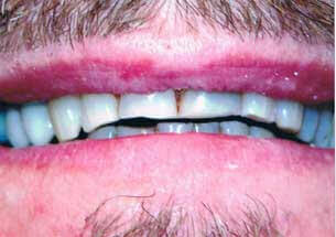 Before smile design treatment patient case study