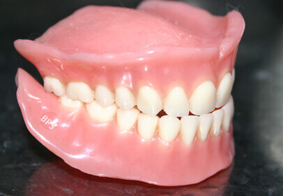 BPS Dentures - Denticare