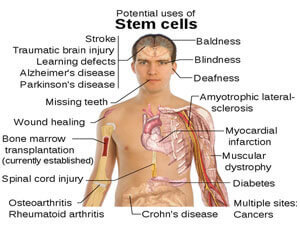 Dental stem cell banking procedure illustration at DentiCare India